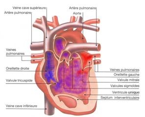 imagini cardiopatii congenitale